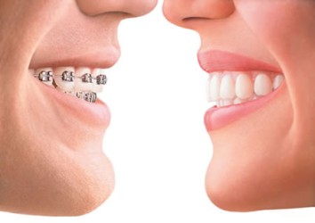Jiaonan Orthodontics Insurance - Jiaonan Dental Insurance Guide
